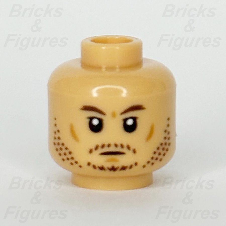 epi