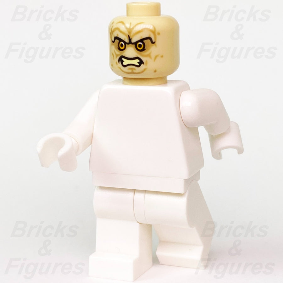 epi
