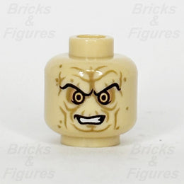 epi