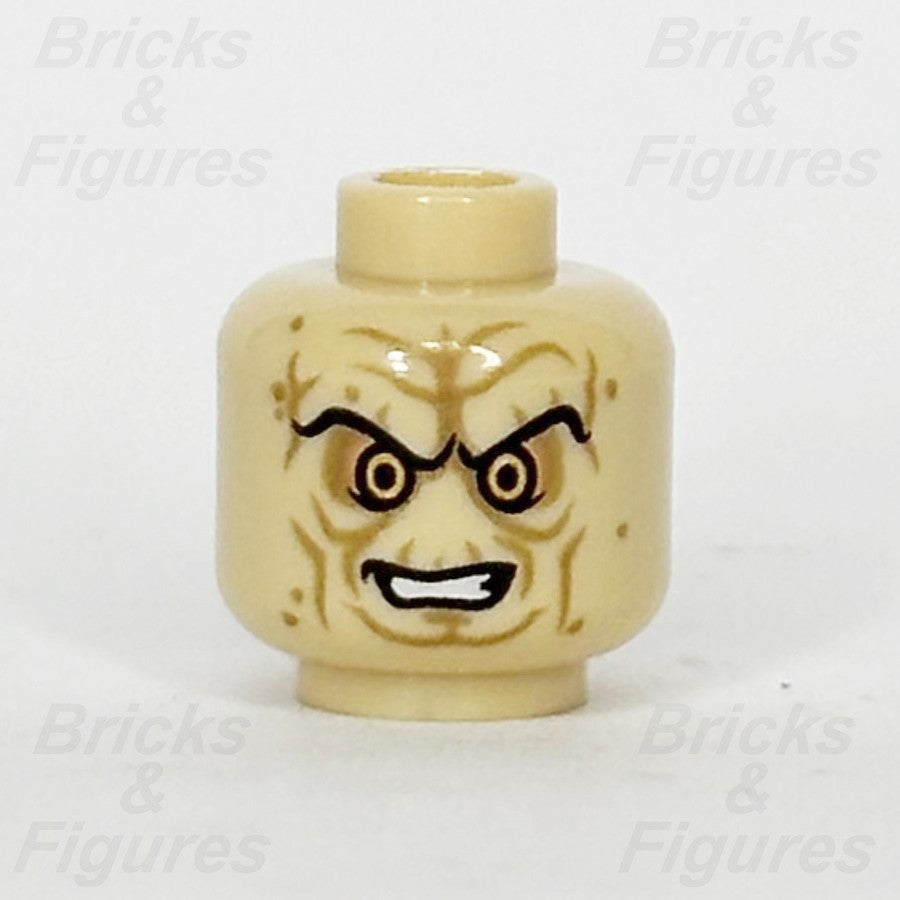 epi
