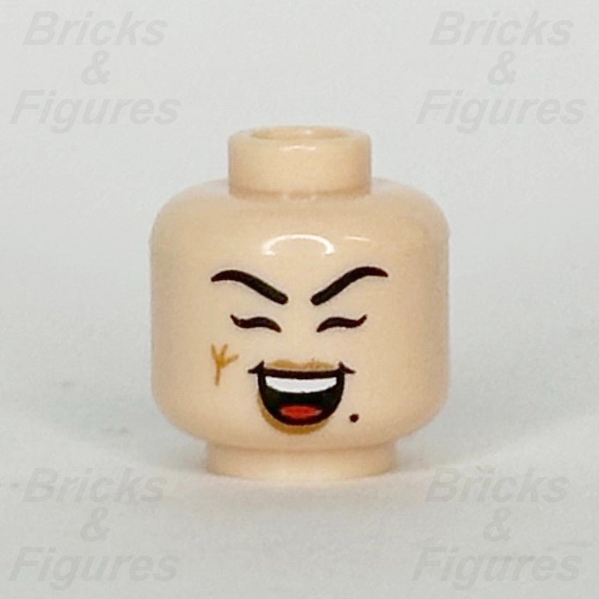 epi